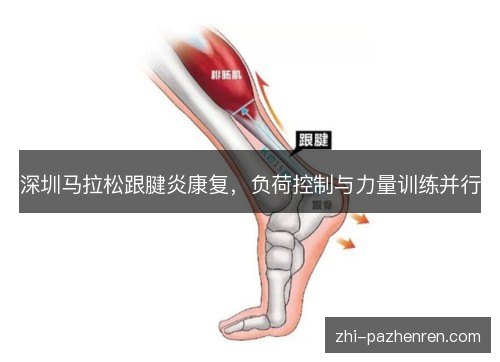 深圳马拉松跟腱炎康复,负荷控制与力量训练并行 深圳马拉松跟腱炎康复,负荷控制与力量训练并行